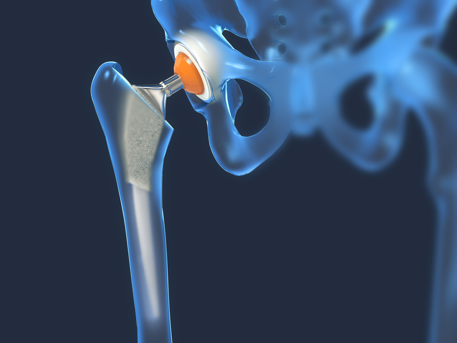 What Makes Medical Grade Metal Suppliers Different from Others? Insights from Banner Industries — A Medical Grade Metal Supplier in Milwaukee, Wisconsin